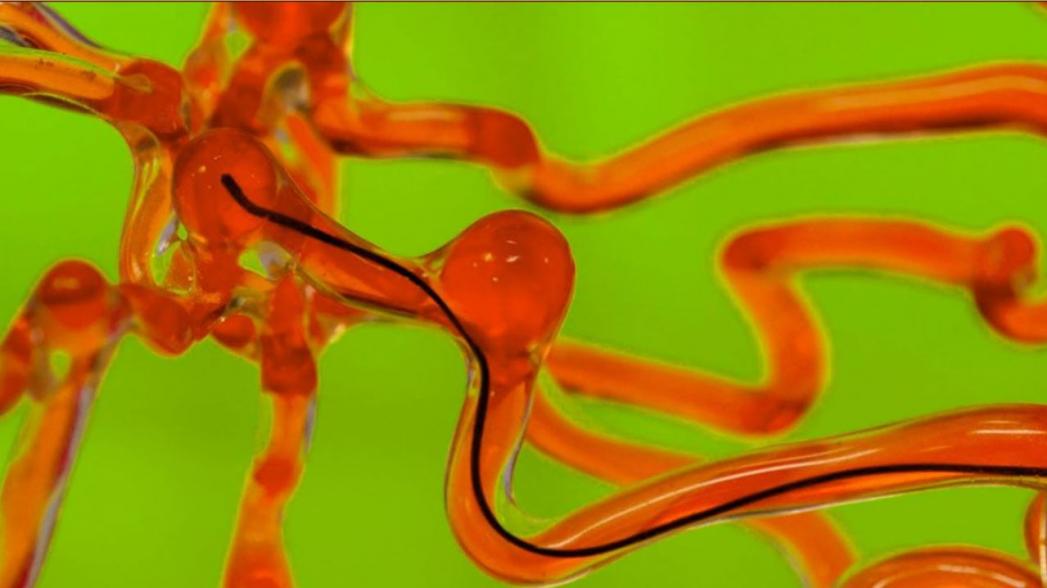 Робот-червь, который может перемещаться по артериям мозга