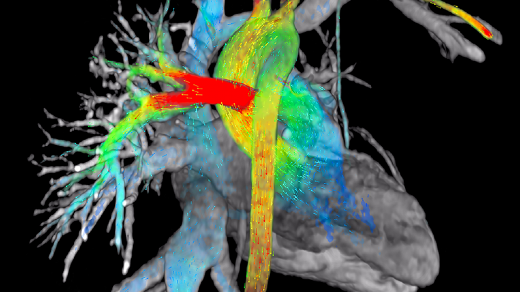 Приложение для визуализации потоков крови в сердце и вокруг него